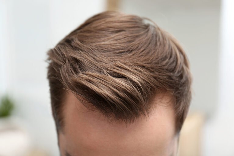 How to Style a Widows Peak Haircut for Men